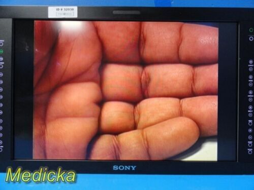 SONY 2013 Olympus  LMD-2451MT/3GA HD LCD Display Monitor