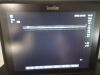 SONOSITE Edge II / 2 with HFL50x