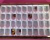 UNITEK Molar & Bicuspid Aluminum Gold Crown 65 pc  Dental Molar   Bicuspid Gold Aluminum Preformed Permanent Crown