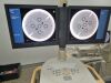 PHILIPS Veradius C-Arm