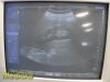 SIEMENS 2010  CH4-1 Convex Array Ultrasound Transducer
