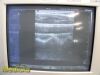 SIEMENS 2014  VFX9-4 P/N 05936237 Multi-D Linear Array Ultrasound Probe/ Ultrasound Transducer