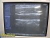 SIEMENS 2012  VF13-5 (04838848) Linear Array Ultrasound Transducer