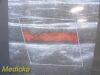 SIEMENS 2012  VF13-5 (04838848) Linear Array Ultrasound Transducer