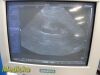 SIEMENS PH4-1 Model 7466910 Sector Array Ultrasound Transducer