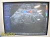 SIEMENS PH4-1 Model 7466910 Sector Array Ultrasound Transducer