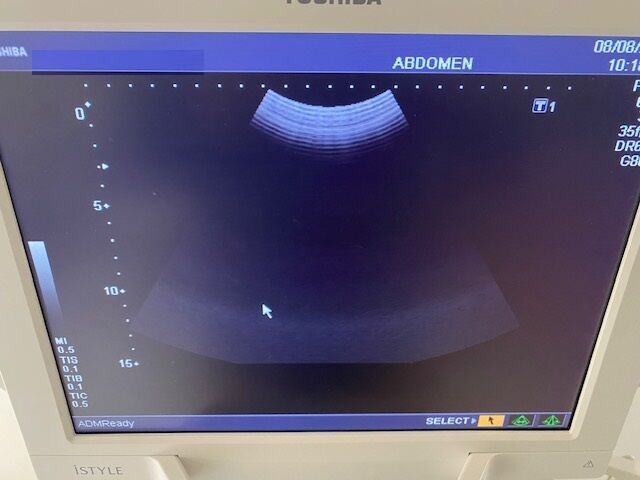 TOSHIBA Nemio XG Ultrasound - Shared Service