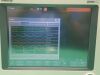 MINDRAY DPM 6+ Patient Monitor (Software: V5.0)
