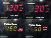 GE 2014  Dinamap V100 Carescape, W/ PSU, NEW BATTERY, Leads ~ Patient Monitor