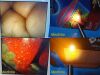 OLYMPUS Circon ACMI LAP 11-56W Laparoscopic Tubal Ligation Set W/ Case