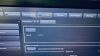 PHILIPS Epiq 5G YOM 2016 General Ultrasound