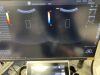 GE Logiq P10 Ultrasound System