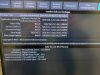 GE Logiq P10 Ultrasound System