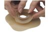 HOLLISTER INC. 79530 Adapt Ostomy Barrier Rings