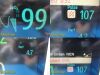 PHILIPS Intellivue Neonatal MP70,Ref M8007A W/ Module & Leads ~ Monitor