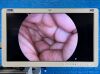 KARL STORZ Spies LED Tower TC200, TC300, TH104, H3-P, Endomat, Thermoflator Laparoscope
