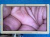 KARL STORZ Spies LED Tower TC200, TC300, TH104, H3-P, Endomat, Thermoflator Laparoscope