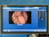 KARL STORZ Spies LED Tower TC200, TC300, TH104, H3-P, Endomat, Thermoflator Laparoscope