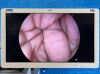 KARL STORZ Spies LED Tower TC200, TC300, TH104, H3-P, Endomat, Thermoflator Laparoscope
