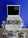 SIEMENS Acuson P300 Ultrasound System