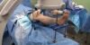 INNOVISION IN004 Russell Frame Lower Extremity Positioner