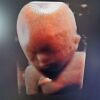 GE Voluson E10 Ultrasound - OB / GYN - Vascular
