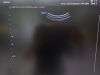 SAMSUNG V4-8 Ultrasound Transducer