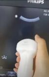 PHILIPS 5-2 Ultrasound Transducer