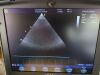 GE 5S-RS Ultrasound Transducer