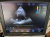 GE 5S-RS Ultrasound Transducer
