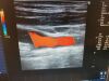 GE 8L-RS Ultrasound Transducer