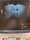 GE IC5-9-D Ultrasound Transducer