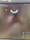 GE IC5-9-D Ultrasound Transducer