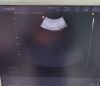 MEDISON 3D4-8ET Ultrasound Transducer