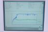 UROLOGIX 5000A Coolwave Urodynamic System