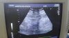 TOSHIBA PVM375AT Ultrasound Transducer