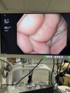 OLYMPUS GIF-HQ190 Gastroscope