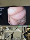 OLYMPUS GIF-XP190N Gastroscope