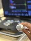 GE vivid iQ Ultrasound - Vascular - Small Parts