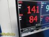 PHILIPS VS3 Sure Signs Vitals ,(NBP & SpO2) W/ Patient Leads ~ Monitor