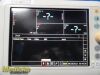 PHILIPS VS3 Sure Signs Vitals ,(NBP & SpO2) W/ Patient Leads ~ Monitor