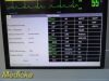 SIEMENS 2011 Drager Infinity Delta Patient Monitor