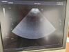 TOSHIBA PST-20CT Ultrasound Transducer