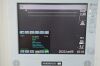 SONOSITE 180 Plus Ultrasound System P02462-04 W/ Transducer L38/10-5MHz &amp; MediFlat-15 Screen - 169370 Imaging System