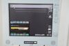 SONOSITE 180 Plus Ultrasound System P02462-04 W/ Transducer L38/10-5MHz &amp; MediFlat-15 Screen - 169370 Imaging System