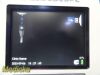 VERATHON Glidescope 0570-0338 AVL, W/ Video Cable, ERGO Stand & PSU~, Monitor