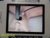 VERATHON Glidescope 0570-0338 AVL,W/ VIDEO Cable, ERGO Stand & PSU~ Monitor