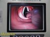 VERATHON Glidescope 0570-0338 AVL,W/ VIDEO Cable, ERGO Stand & PSU~ Monitor
