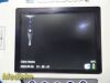 VERATHON Glidescope 0570-0338 AVL,W/ VIDEO Cable, ERGO Stand & PSU~ Monitor