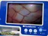 VERATHON Glidescope Portable GVL,W/ 0574-0001 Baton, Cradle, Stand~, Monitor